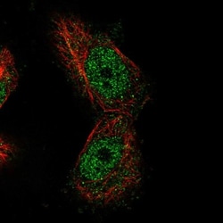 MTF1 Antibody, Novus Biologicals 25 &mu;L; Unlabeled:Antibodies, Polyclonal